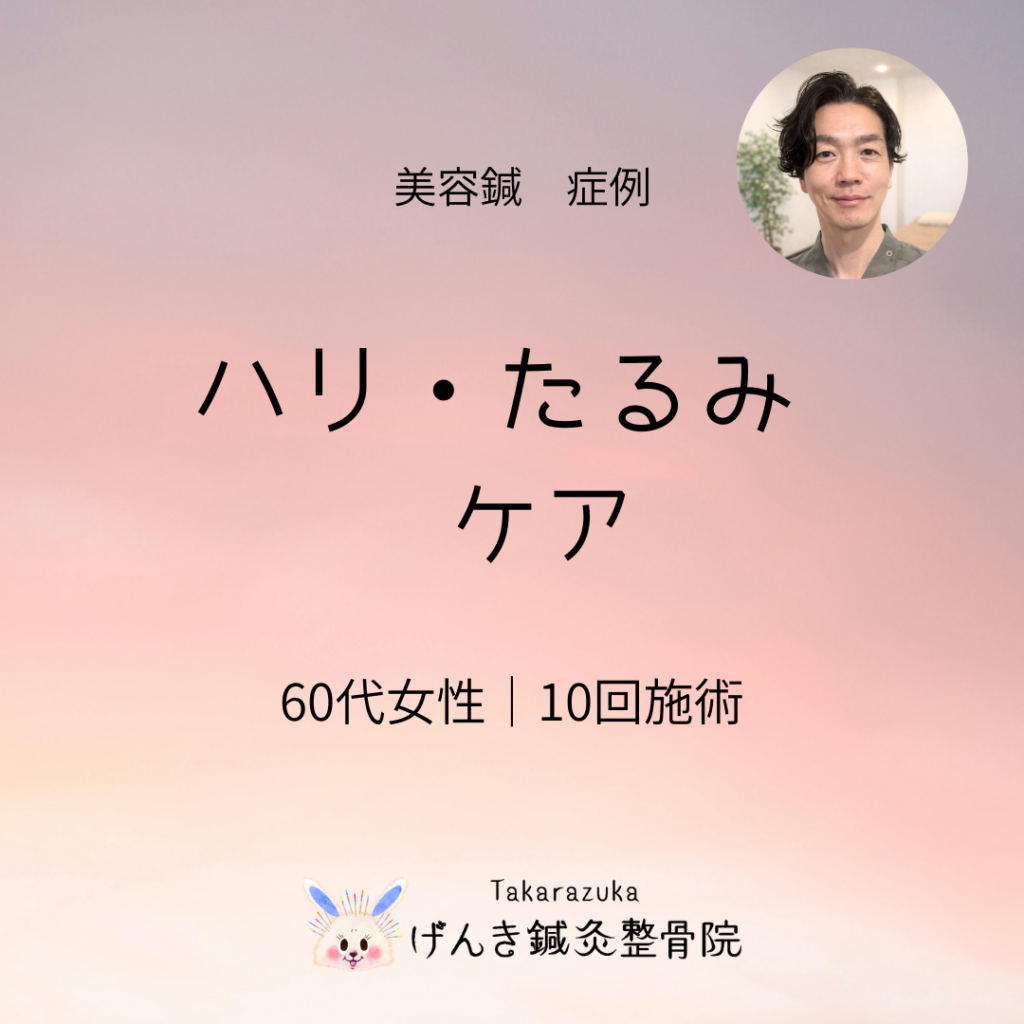 【症例】宝塚市 60代女性｜ハリ低下とたるみのお悩み｜美容鍼10回経過（美顔プレミアム100本）