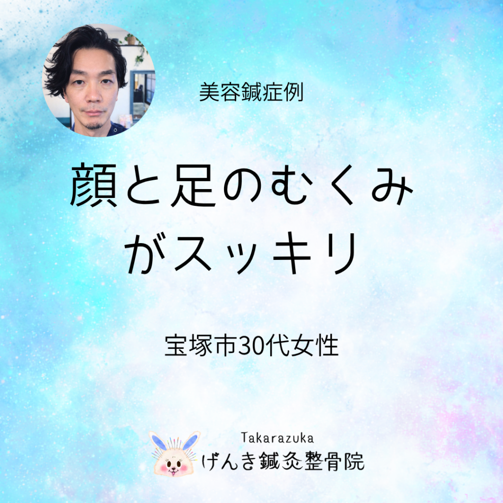 【症例】宝塚市 30代女性｜顔と足のむくみが改善したケース